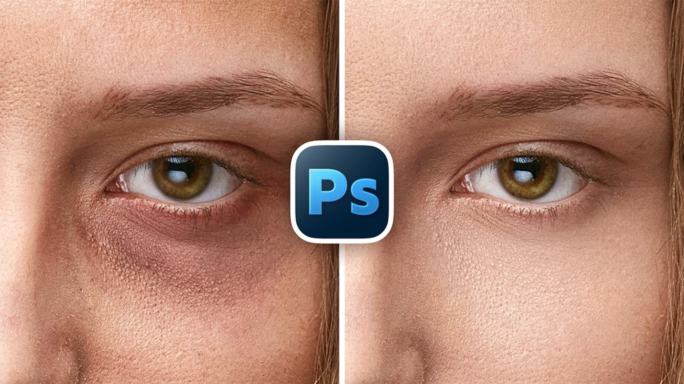 Eye Bags PiXimperfect Feature Image